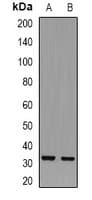 Polyclonal Rabbit anti-Human TRP32 / TXNL1 Antibody (IHC, IF, WB)