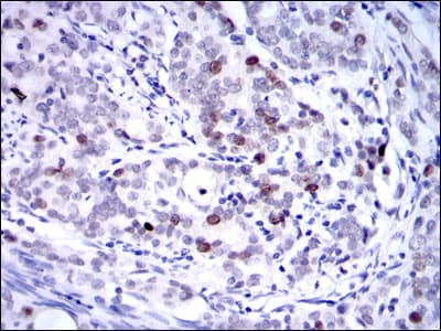 KIF22 / OBP Antibody (clone 5F3)
