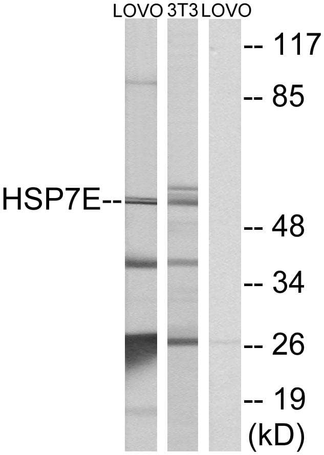 HSP70L1 / HSPA14 Antibody
