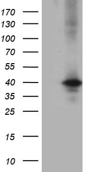 UP2 / UPP2 Antibody (clone OTI9G9)