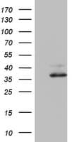 OTC Antibody (aa33-354, clone OTI8A1)