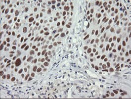 SOLO / SESTD1 Antibody (clone OTI2E7)