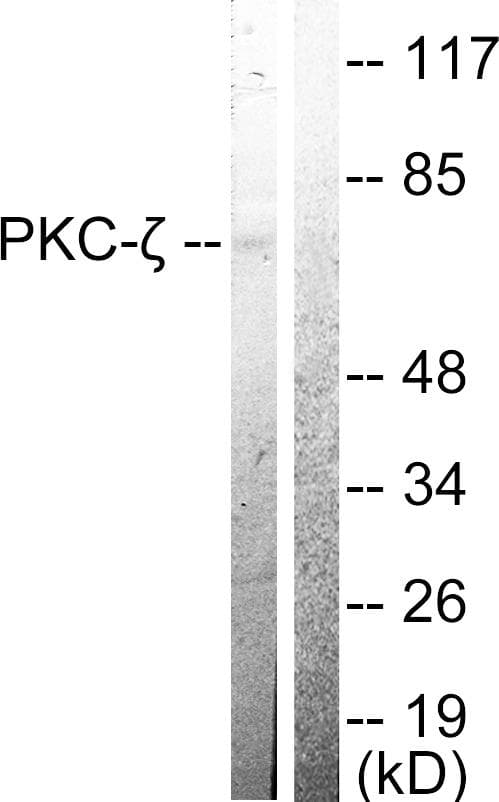 PRKCZ / PKC-Zeta Antibody (p410)