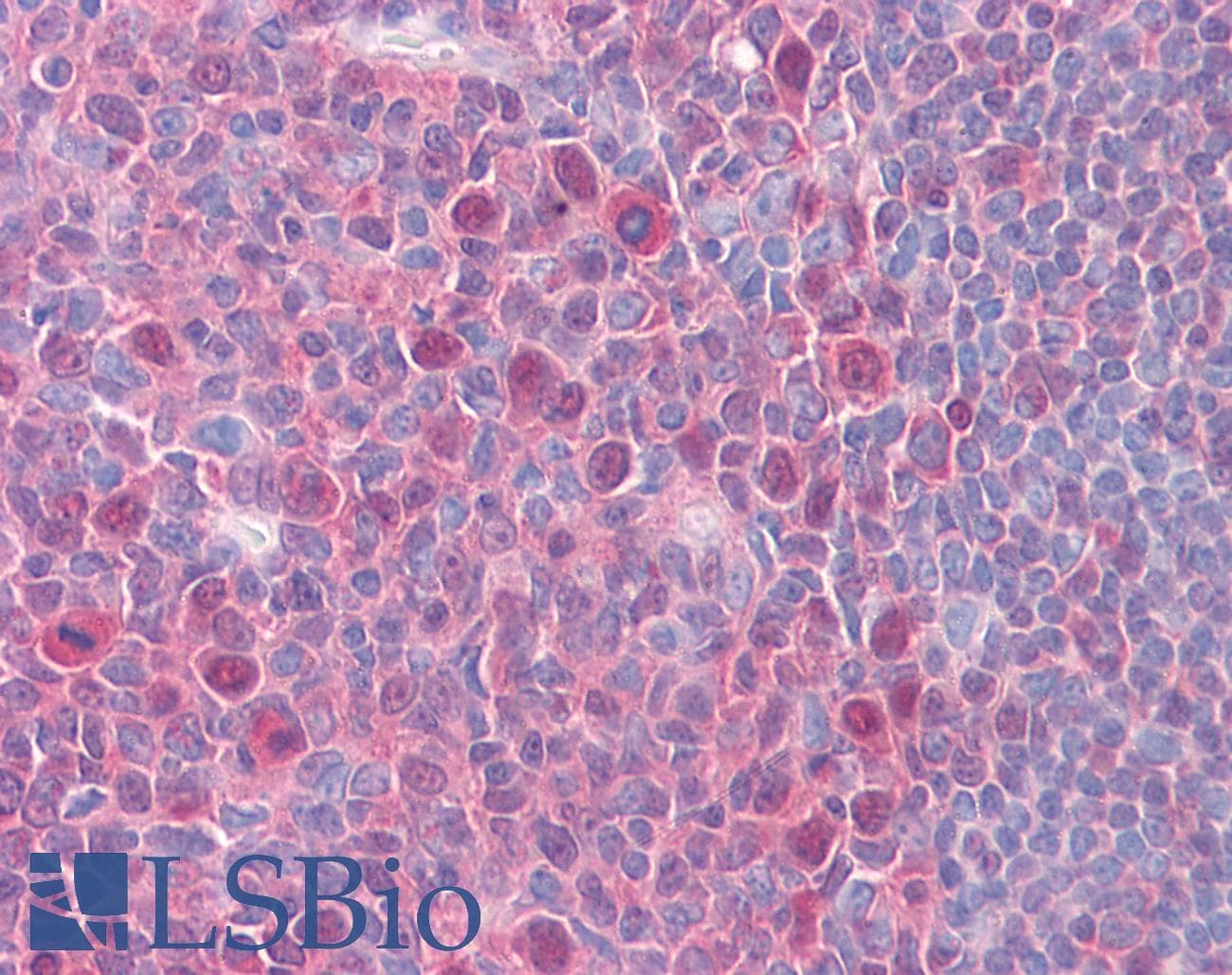 IHC-plus™ Monoclonal Mouse anti-Human CSE1L Antibody (clone 2F4, IHC, IF, WB)