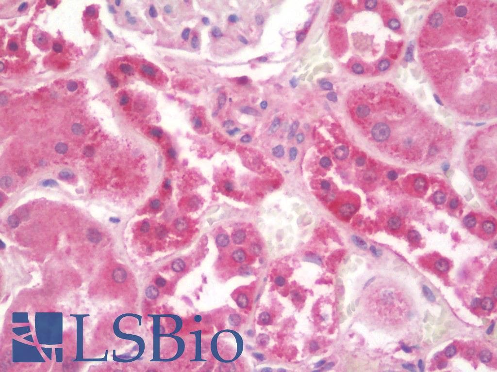 IHC-plus™ FHIT Antibody