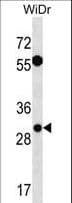 Polyclonal Rabbit anti-Human EXOSC6 Antibody (aa12-38, WB)