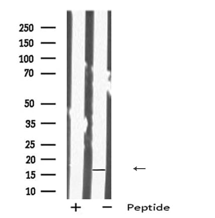IMMP1L Antibody
