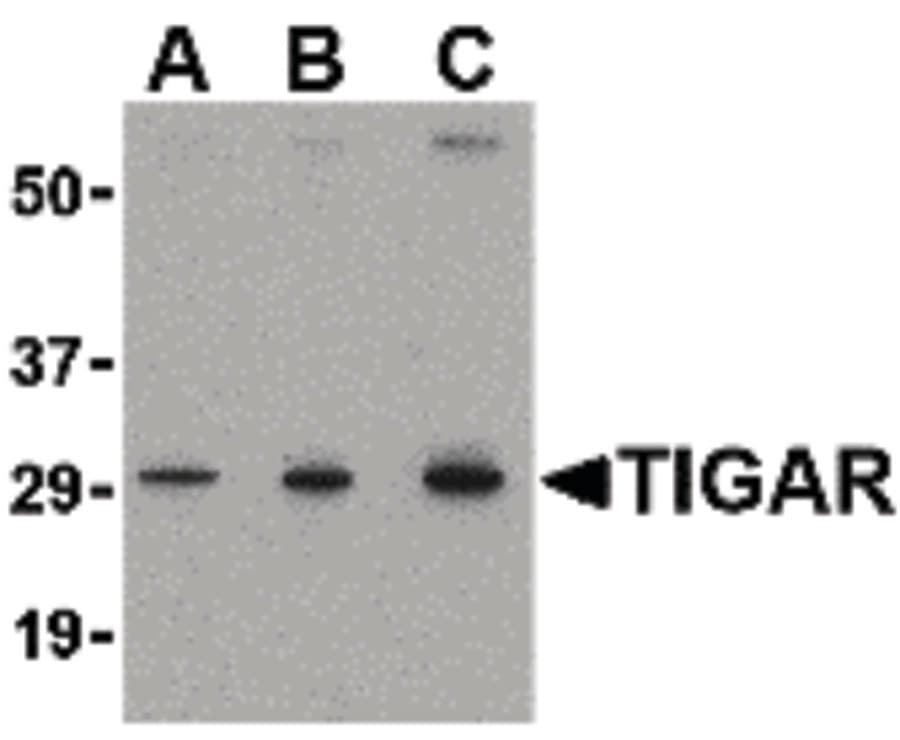 IHC-plus™ TIGAR Antibody