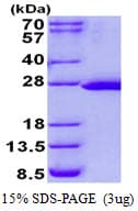 Human FTSJ2 Protein (Recombinant His)