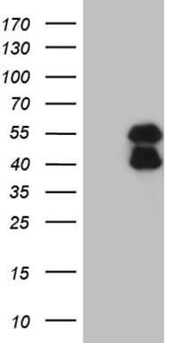 BCL7B Antibody (clone OTI3C1)