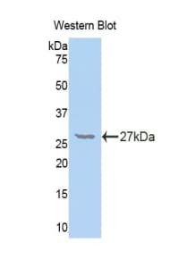 NFKB2 Antibody (aa35-225)
