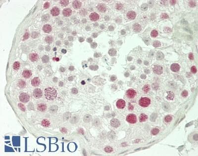 IHC-plus™ RIF1 Antibody (aa1425-1450)