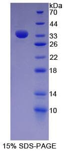 Human FN1 / Fibronectin Protein (Recombinant His)