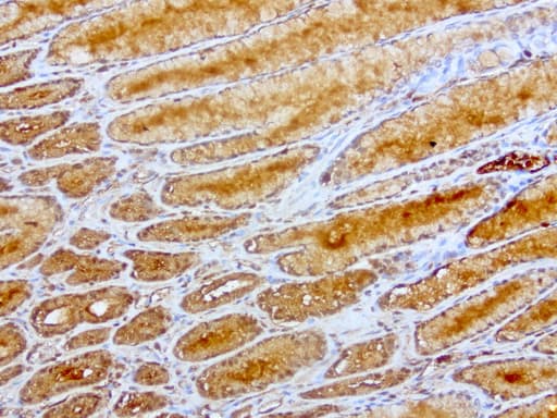 HP / Haptoglobin Antibody (clone UMAB10)