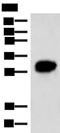 Polyclonal Rabbit anti-Human HCCS Antibody (IHC, WB)