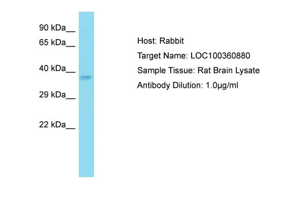 FOSB Antibody (N-Terminus)