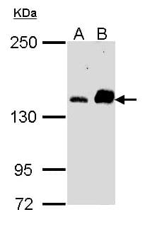 IHC-plus™ CARMA1 / CARD11 Antibody
