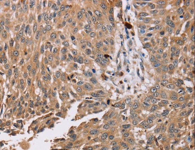 PDLIM7 / Enigma Antibody