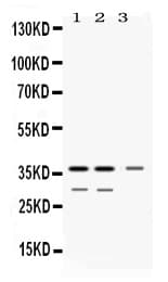 Polyclonal Rabbit anti-Human DDAH1 Antibody (WB)