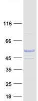 Human C9orf24 Protein (Recombinant Myc-DDK (Flag))