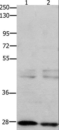 GnRH receptor / GNRHR Antibody
