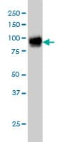 Monoclonal Mouse anti-Human FBLN1 / Fibulin 1 Antibody (clone 4C9, WB)