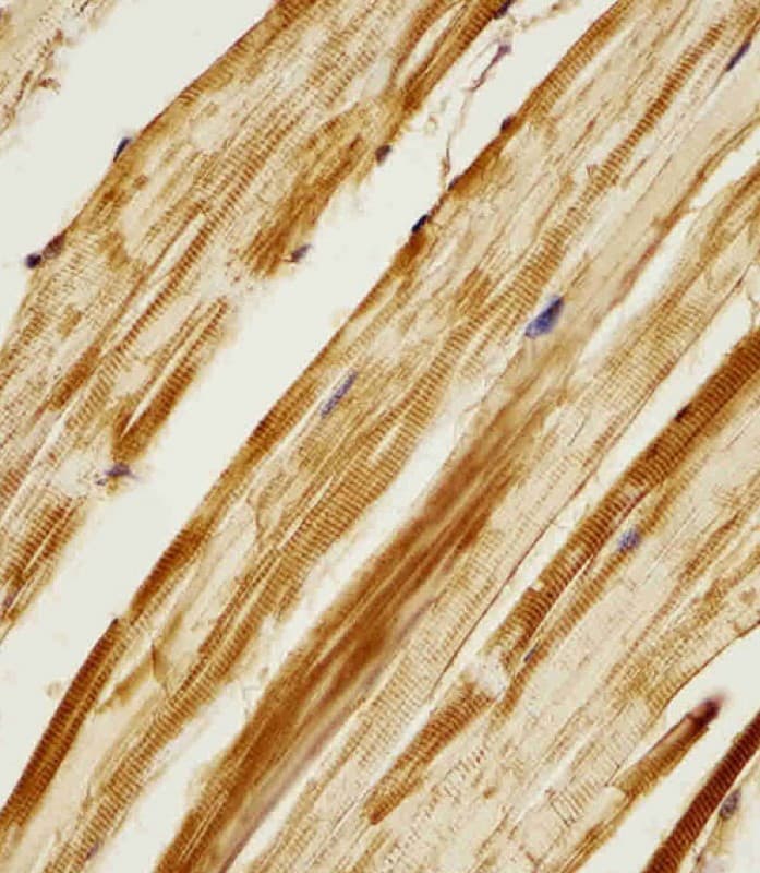 AK2 / Adenylate Kinase 2 Antibody (aa147-183)