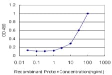 Monoclonal Mouse anti-Human NBN / Nibrin Antibody (clone 3E4, WB)