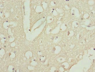 CAMK1D Antibody