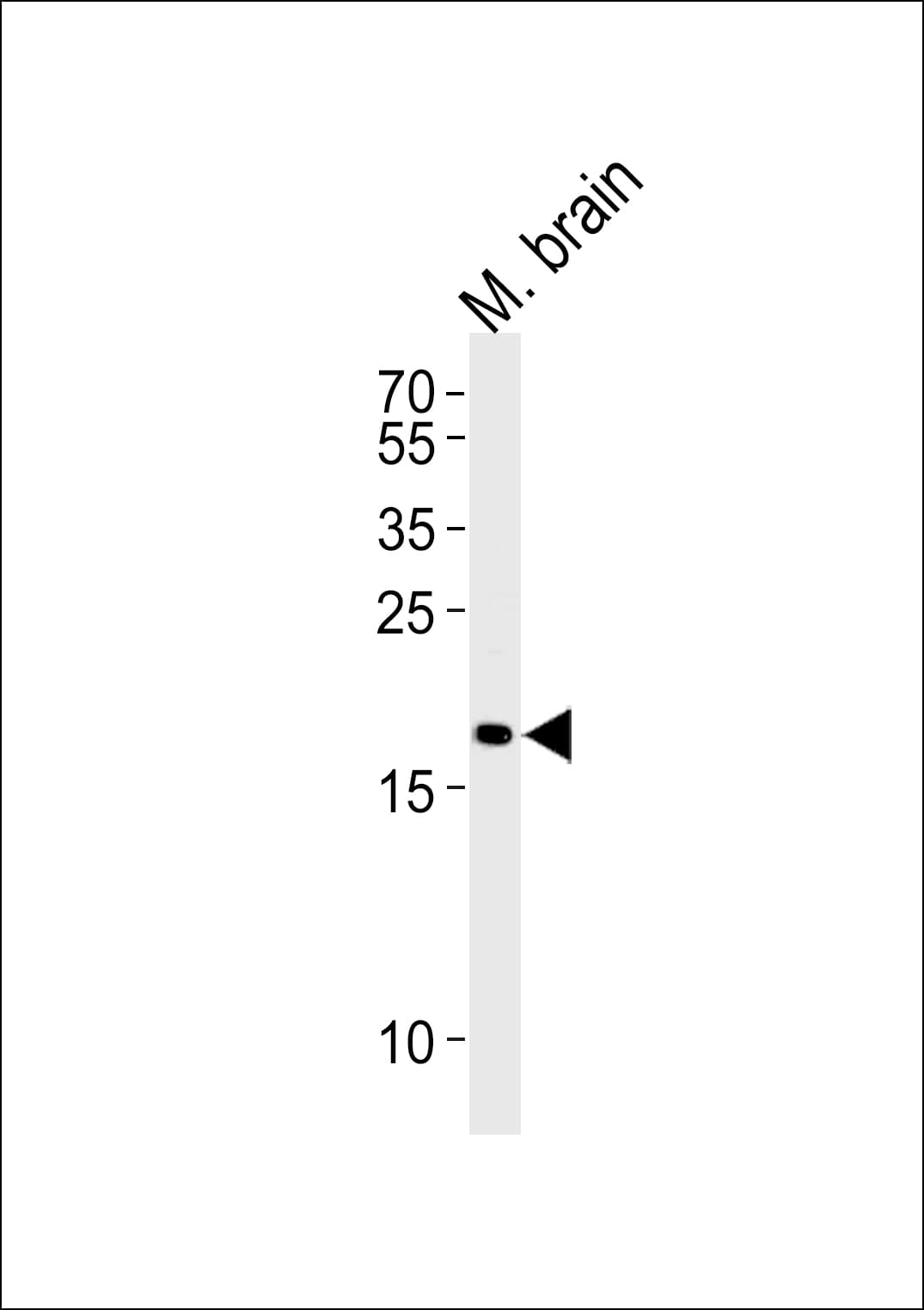 CPLX2 / Complexin 2 Antibody (aa51-83)