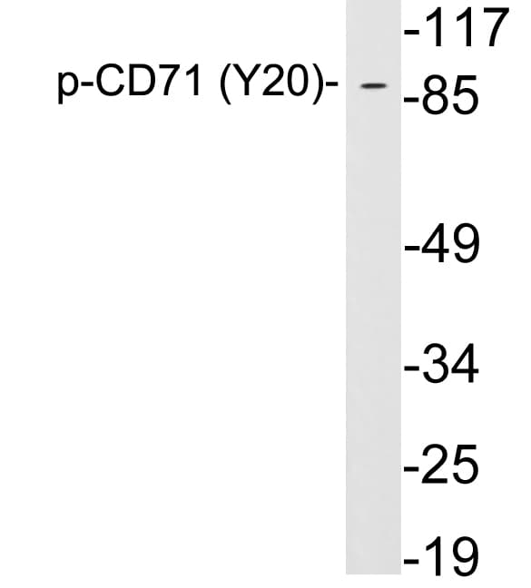 Polyclonal Rabbit anti-Human CD71 / Transferrin Receptor Antibody (phospho-Tyr20, WB)