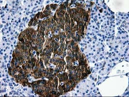 Monoclonal Mouse anti-Human MAC-2-BP / LGALS3BP Antibody (clone OTI6B7, IHC, WB)