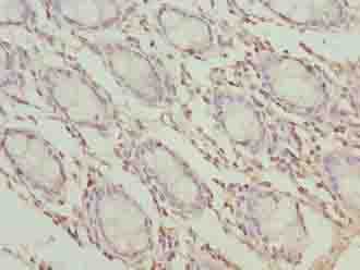TMEM65 Antibody