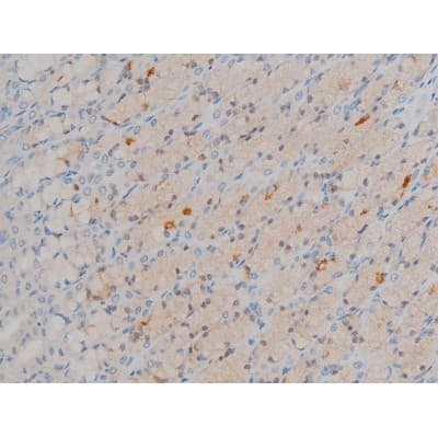 Polyclonal Rabbit anti-Human BCL2 / Bcl-2 Antibody (phospho-Ser70, IHC, IF, WB)