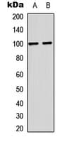 GRIA2 / GLUR2 Antibody (phospho-Ser880)