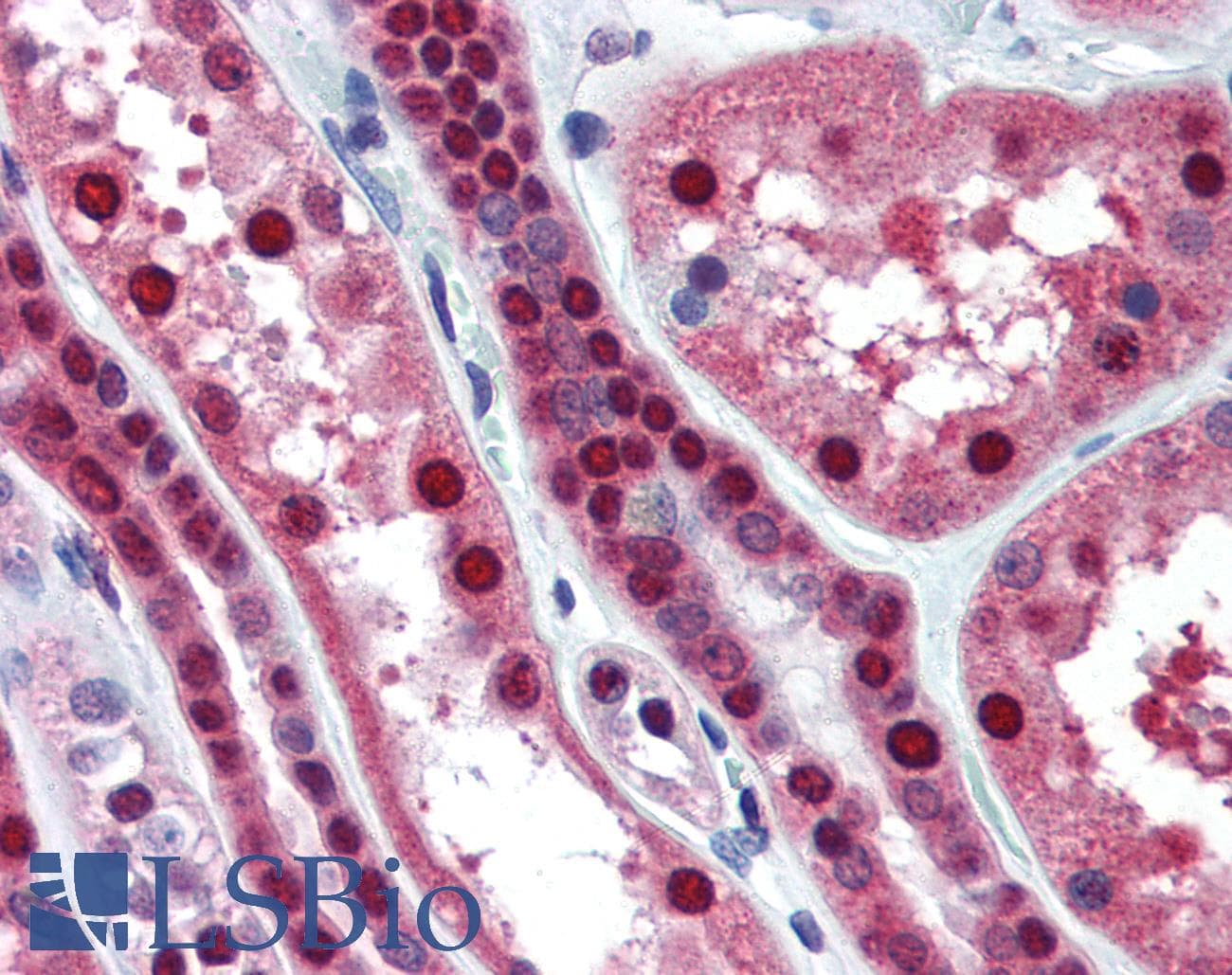 IHC-plus™ Monoclonal Mouse anti-Human MAT2A Antibody (clone AT3A2, aa1-395, IHC, WB)