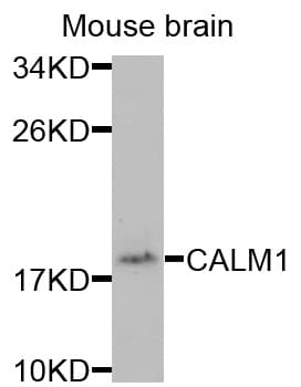 Polyclonal Rabbit anti-Human CALM1 / Calmodulin Antibody (IHC, WB)