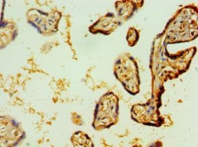IL1R1 Antibody (aa18-320)