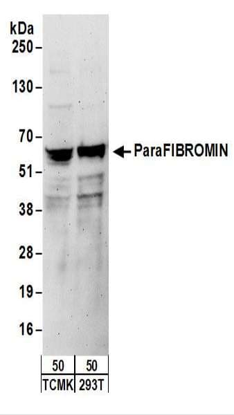 CDC73 / Parafibromin Antibody (aa250-300)