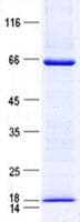 Human ZFYVE19 Protein (Recombinant His, N-Terminal)