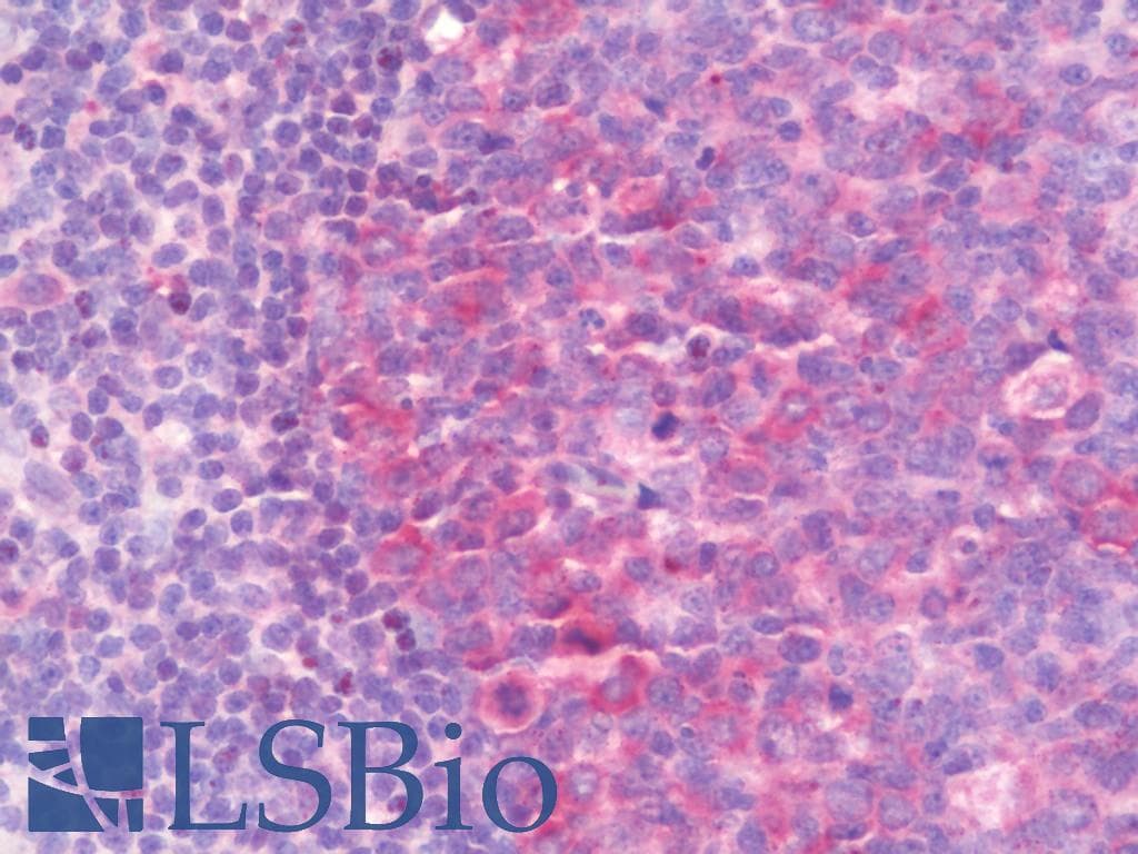 IHC-plus™ Polyclonal Rabbit anti-Human IMPDH1 Antibody (aa84-113, IHC, WB)