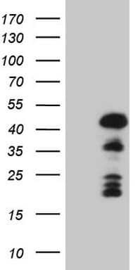 MKX Antibody (clone OTI6B12)