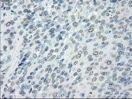 AURKC / Aurora C Antibody (clone OTI2B7)