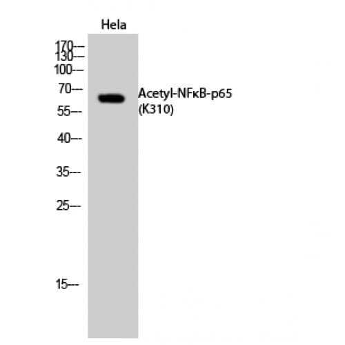 RELA / NFKB p65 Antibody (250-330 aa)