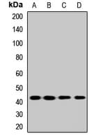 BDKRB2/Bradykinin B2 Receptor Antibody