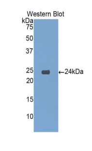 IGFBP6 Antibody (aa51-226, APC)
