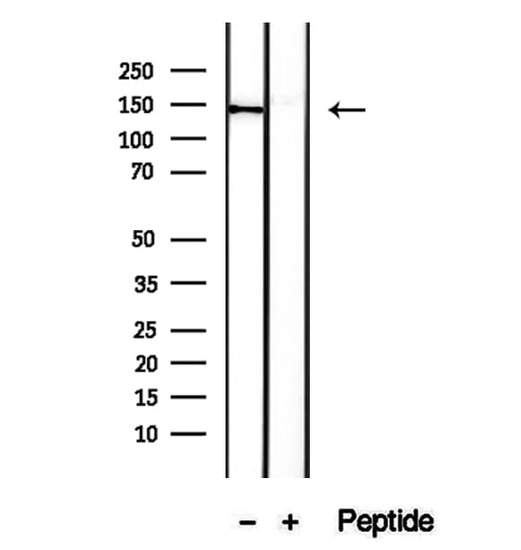 DHX9 Antibody