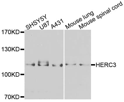 Polyclonal Rabbit anti-Human HERC3 Antibody (IHC, WB)