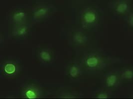 Monoclonal Mouse anti-Human EPCAM Antibody (clone OTI2H9, IF, WB)