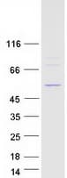 Human DDX47 Protein (Recombinant Myc-DDK (Flag))